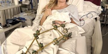 Lindsey Vonn condivide un emozionante aggiornamento dal suo letto d’ospedale dopo che la frattura alla gamba ha infranto il suo sogno di partecipare alle Olimpiadi invernali