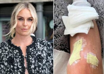 “The Only Failure in Life Is Not Trying”: Lindsey Vonn’s Powerful Message After Devastating Olympic Crash and Successful Surgery