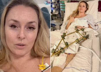“One Step at a Time”: Lindsey Vonn Health Update as She Reveals She’s Having TWO More Surgeries in Emotional Message