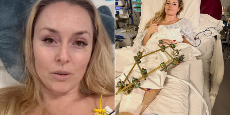 “One Step at a Time”: Lindsey Vonn Health Update as She Reveals She’s Having TWO More Surgeries in Emotional Message