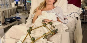 Sky News: Team USA Skier Lindsey Vonn ‘Discharged From Hospital’ a Week After Horror Olympics Crash With Message of Hope — “A Horrible Experience I Know I’ll Bounce Back From…”