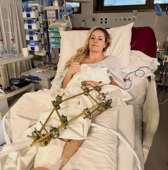 Sky News: Team USA Skier Lindsey Vonn ‘Discharged From Hospital’ a Week After Horror Olympics Crash With Message of Hope — “A Horrible Experience I Know I’ll Bounce Back From…”
