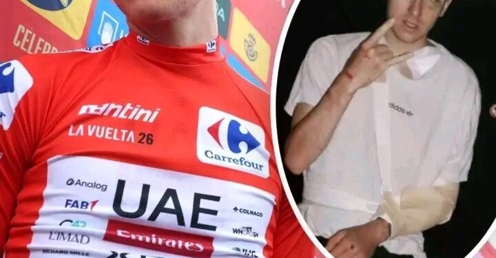 Tadej se bo vrnil močnejši  Od boksarja s podplutim očesom do optimizma glede okrevanja – novice iz kroga najbližjih Tadeja Pogačarja razkrivajo, da je slovenski kolesar povsem osredotočen na vrnitev na vrh, potem ko je njegova sezona zaradi hudega padca na dirki po Španiji (Vuelta) predčasno končala.